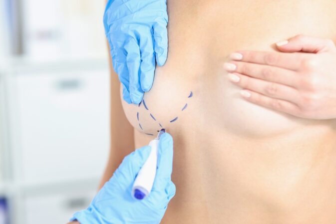 Doctor,Making,Marking,On,Boob,For,Future,Cosmetic,Surgery,Operation